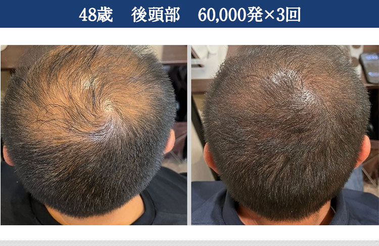 ｜スカルプインク沖縄