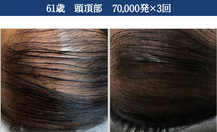 ｜スカルプインク沖縄