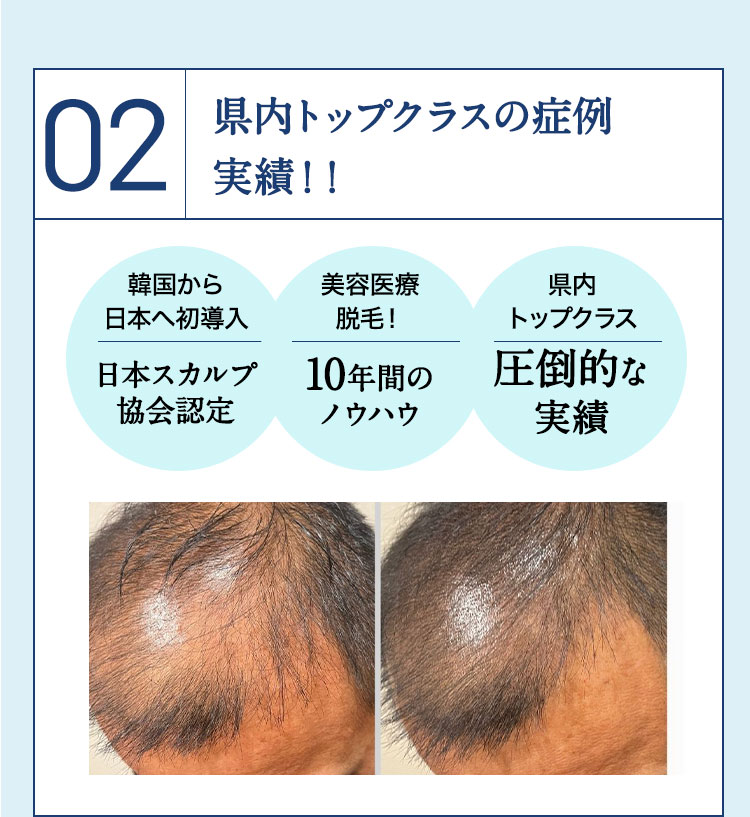 ナチュラルで美しい見た目に仕上げることをお約束します。｜スカルプインク沖縄